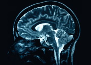 Course 825 Fundamentals of Magnetic-Resonance Imaging (MRI)